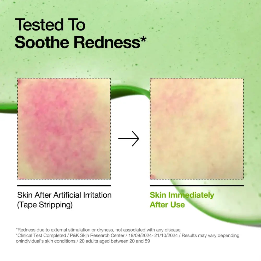 A green-tinted azelaic acid serum for blemish-prone skin showing korean skincare before and after redness soothing results