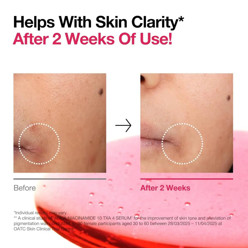 Pink liquid niacinamide 10% txa 4% serum in clear bottle with droplets for korean skincare south tranexamic acid dark spots