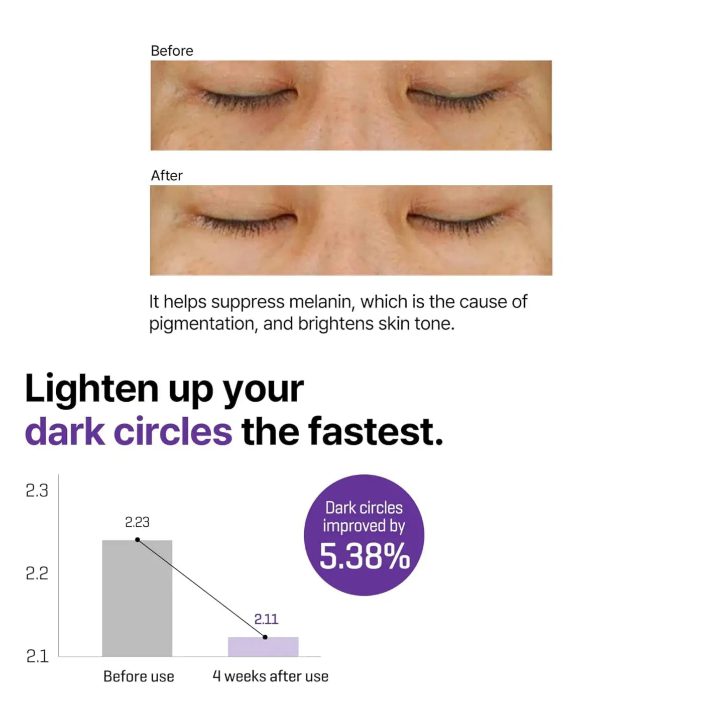 Before and after of under-eye skin showing retinol intense advanced triple action eye cream brightening dark circles
