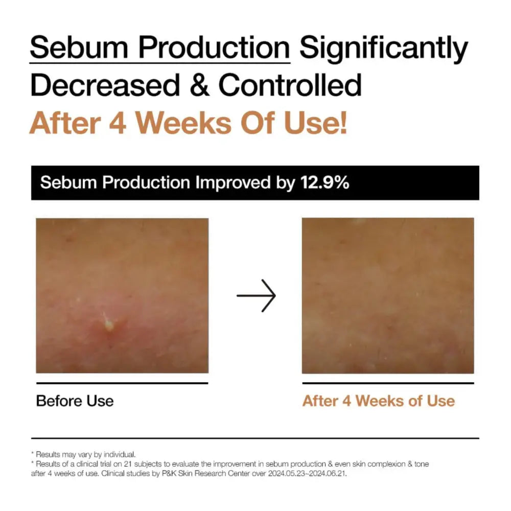 Before and after comparison showing anua rice glow milky toner reducing oiliness and improving skin barrier texture