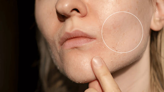 Dehydrated Skin: How to Build a Korean Skincare Routine in South Africa