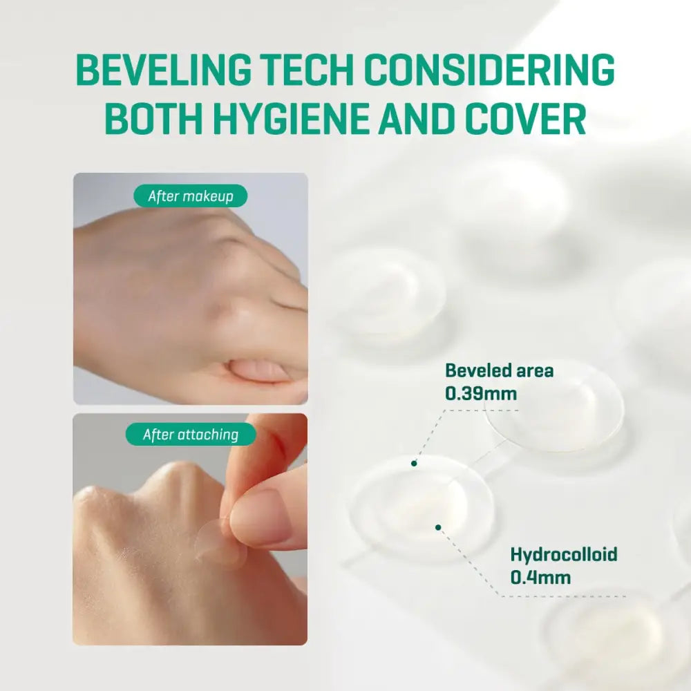 30 Days Miracle Clear Spot Patch - Treatment SomeByMi Acne Patches