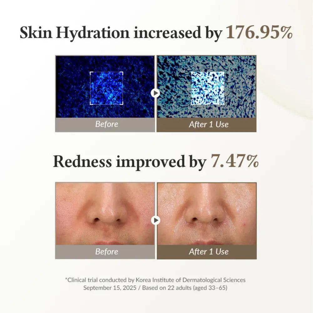 Before and after clinical results of 345 relief cream mask showing increased skin hydration and reduced redness