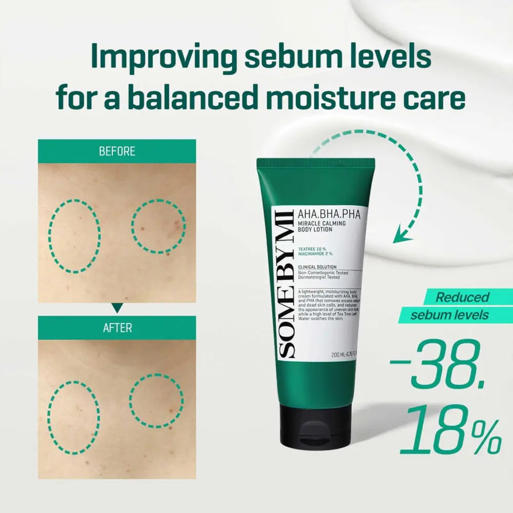 Green tube of some by mi aha bha pha miracle calming body lotion designed for soothing and hydrating skin