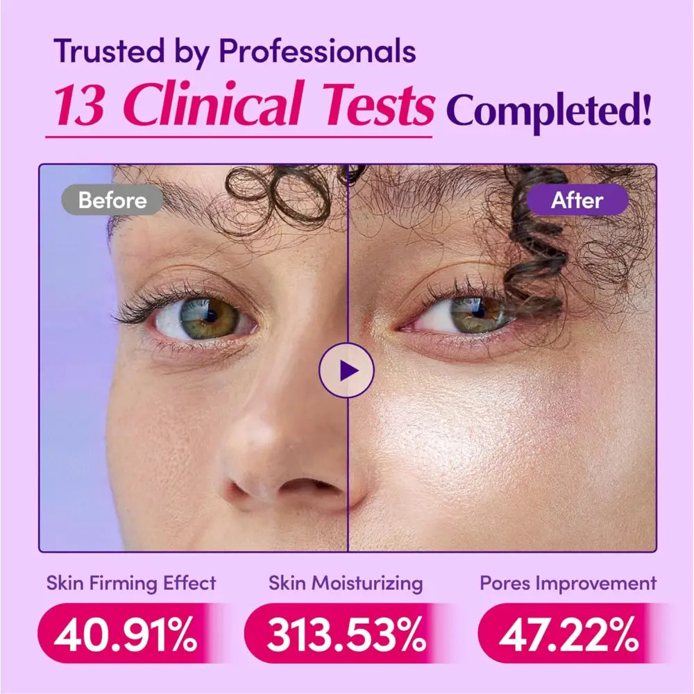 A close-up showing improved skin firmness hydration and pores after using bakuchiol plumping serum korean skincare south africa