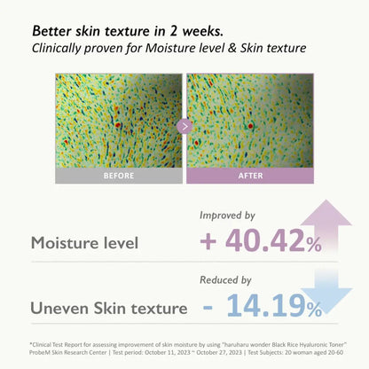 Clinically proven haruharu wonder black rice hyaluronic toner 150ml for improved skin moisture and texture in authentic k-beauty korean skincare south africa