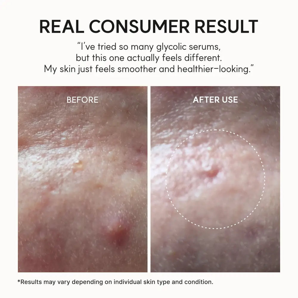 Eraser Shot Glycolic Acid Booster 30ml - Serum and Ampoule Arencia Face Serums