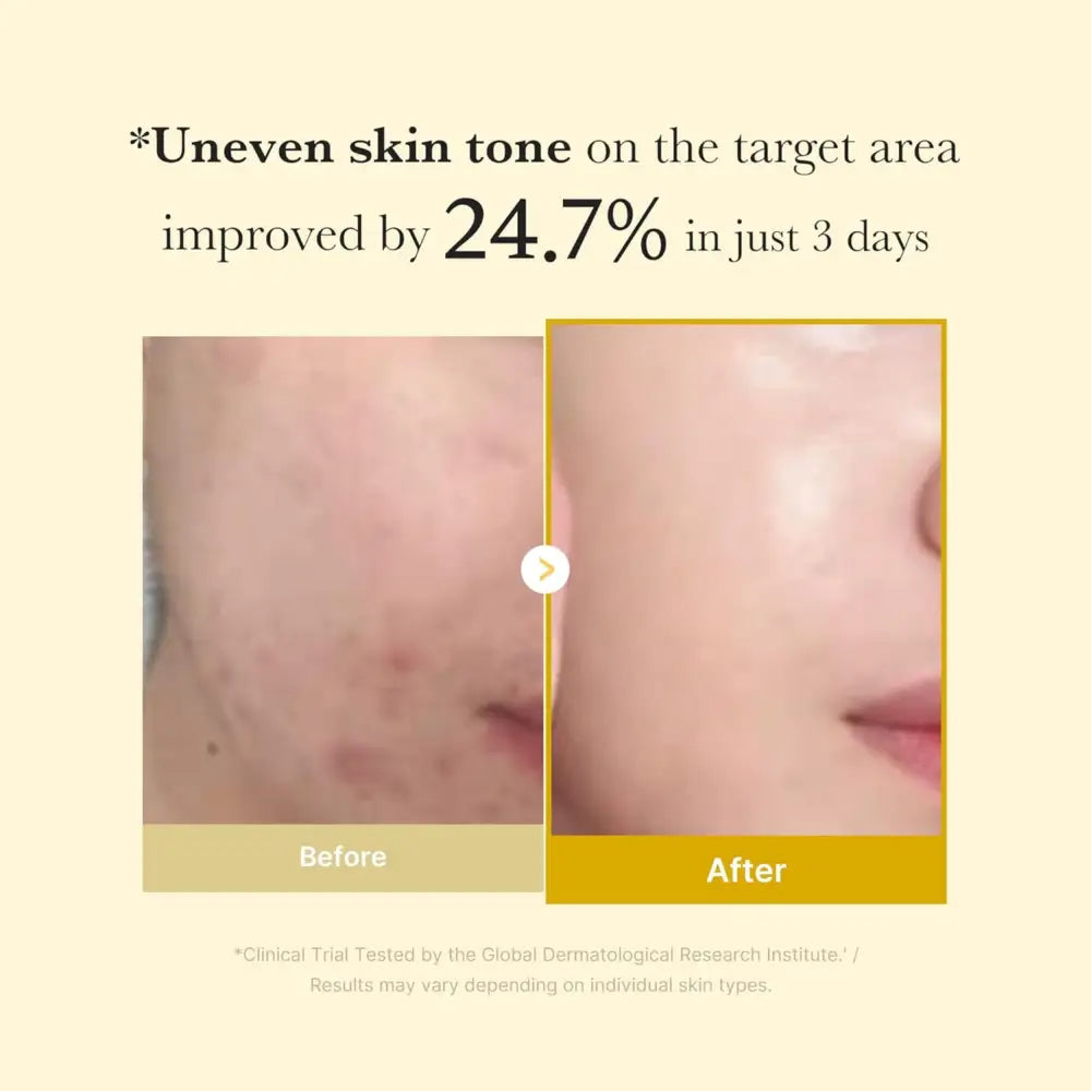 Before and after using kojic acid turmeric overnight wrapping mask showing improved even skin tone and reduced redness