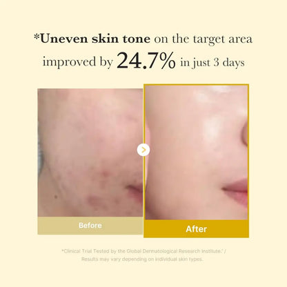 Before and after using kojic acid turmeric overnight wrapping mask showing improved even skin tone and reduced redness