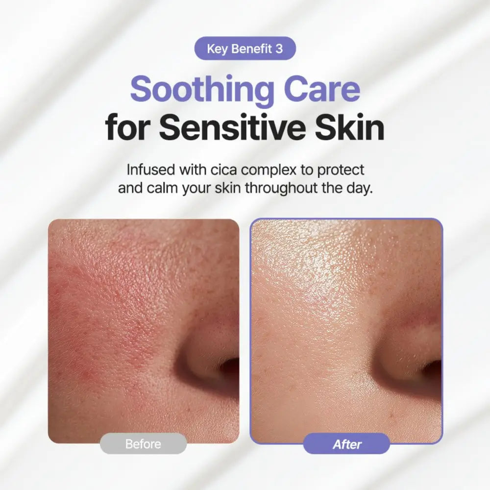 Before-and-after of irritated to calm skin using luminous ceramide moisturizer 100ml with soothing cica complex