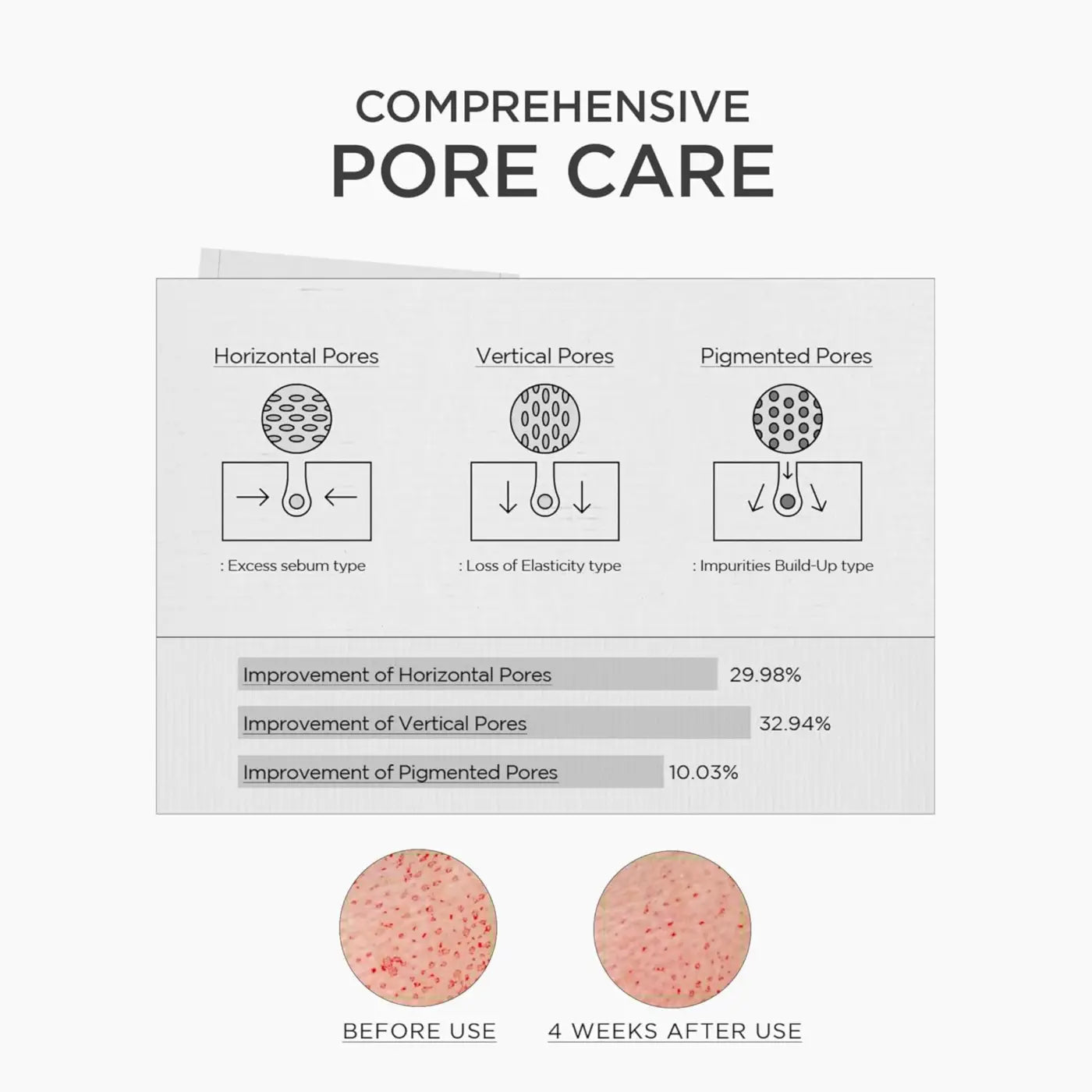 Comprehensive pore care infographic showing before and after results for horizontal, vertical, and pigmented pores using madagascar centella niacinamide boosting shot ampoule 30ml in south africa