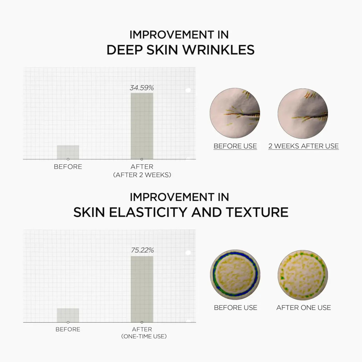 Madagascar centella retinol boosting shot ampoule 30ml shows 34.59% wrinkle reduction and 75.22% skin elasticity improvement