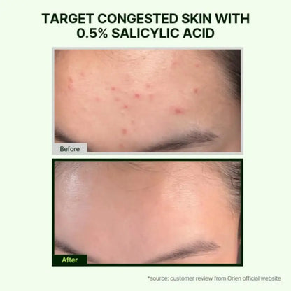 Mugwort zero film cleansing foam 150ml with 0.5% salicylic acid targets congested skin to clear acne and improve complexion