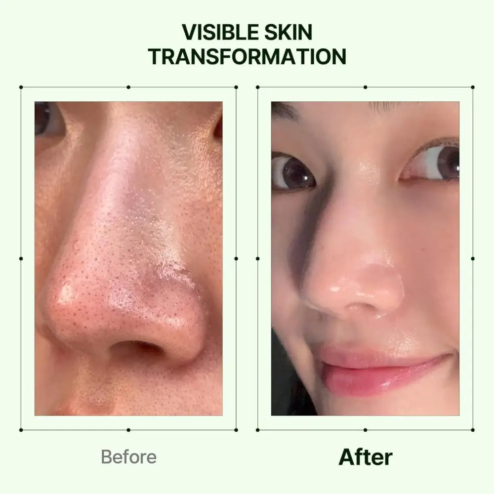 Smooth glowing skin with a subtle pinkish hue after using mugwort zero film cleansing oil 200ml for gentle cleansing