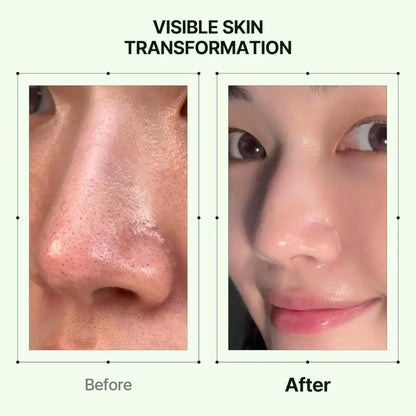 Smooth glowing skin with a subtle pinkish hue after using mugwort zero film cleansing oil 200ml for gentle cleansing