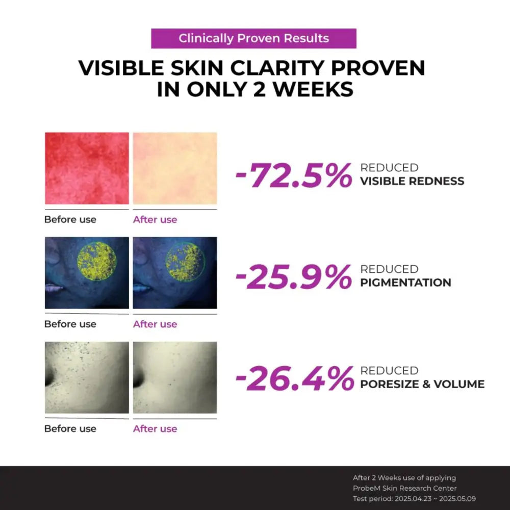 Clinically proven authentic korean niacinamide 10% serum 40ml showing redness pigmentation and pore size reduction results