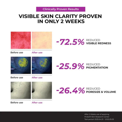 Clinically proven authentic korean niacinamide 10% serum 40ml showing redness pigmentation and pore size reduction results