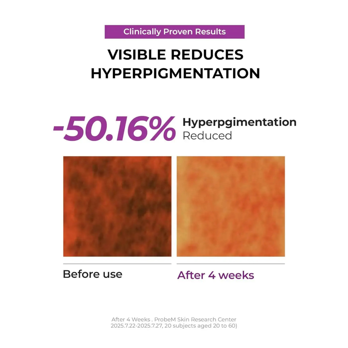 Clinically proven jumiso niacinamide overnight cream 50ml targets dark spots with 50.16% reduction after four weeks