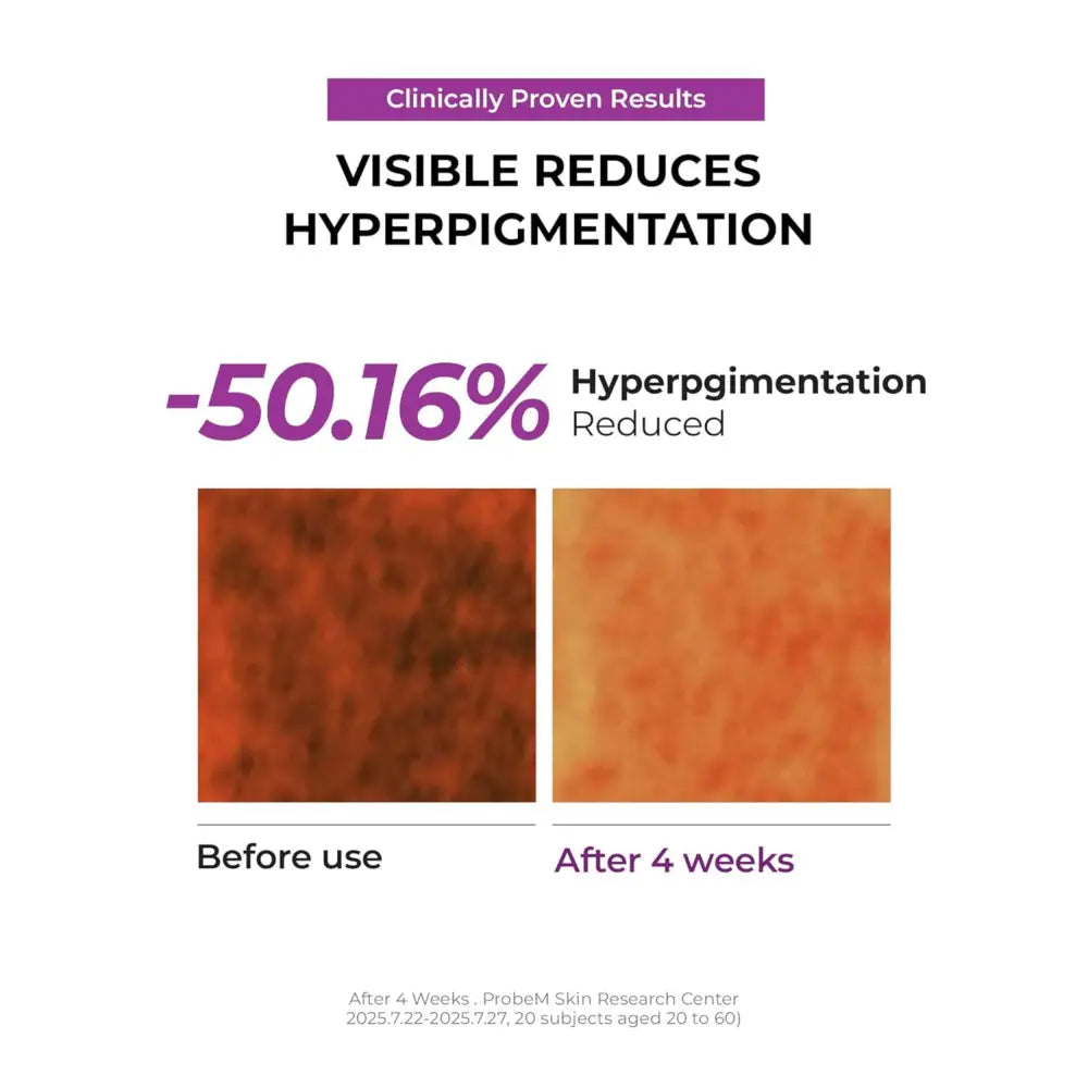 Clinically proven jumiso niacinamide overnight cream 50ml targets dark spots with 50.16 percent reduction in four weeks