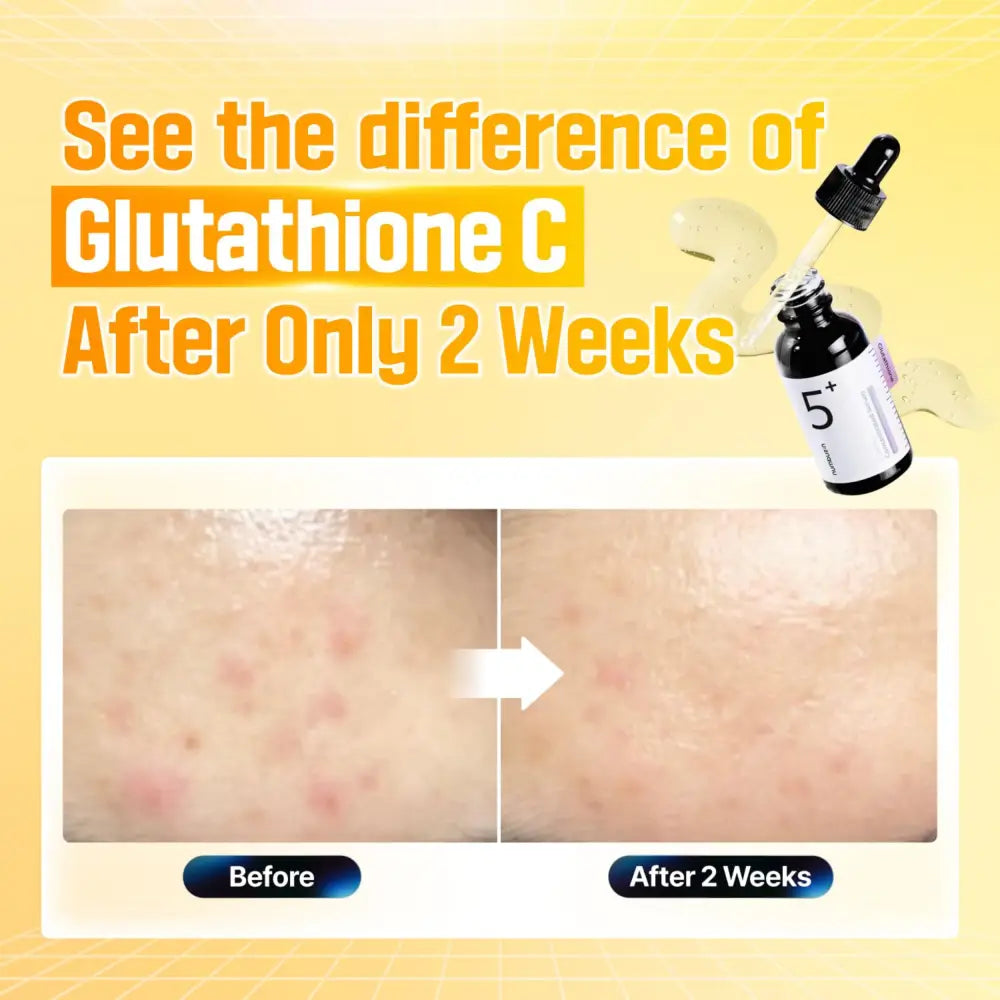 Black glass dropper bottle with white label and black cap labeled 5 plus no.5 plus glutathione vitamin concentrated serum for dark spots