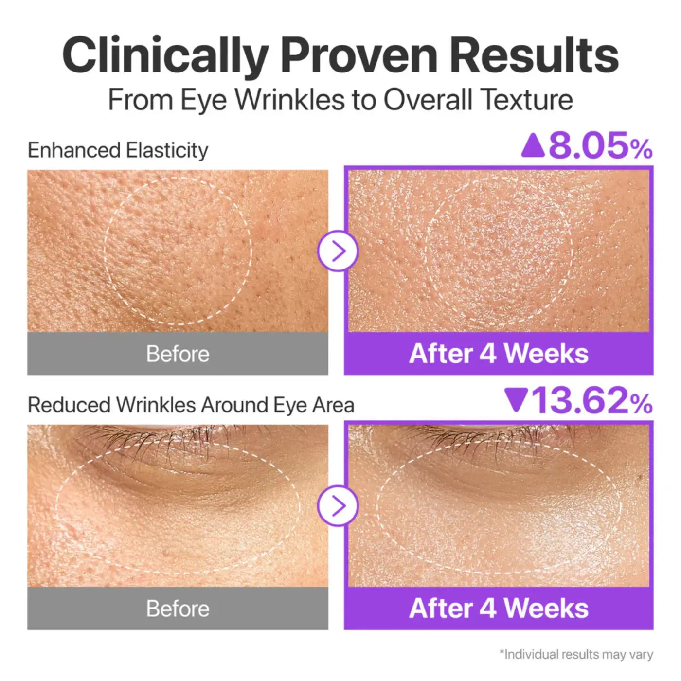 Clinically proven results of no9 nad+ bio lifting-sil essence showing enhanced elasticity and reduced wrinkles after 4 weeks