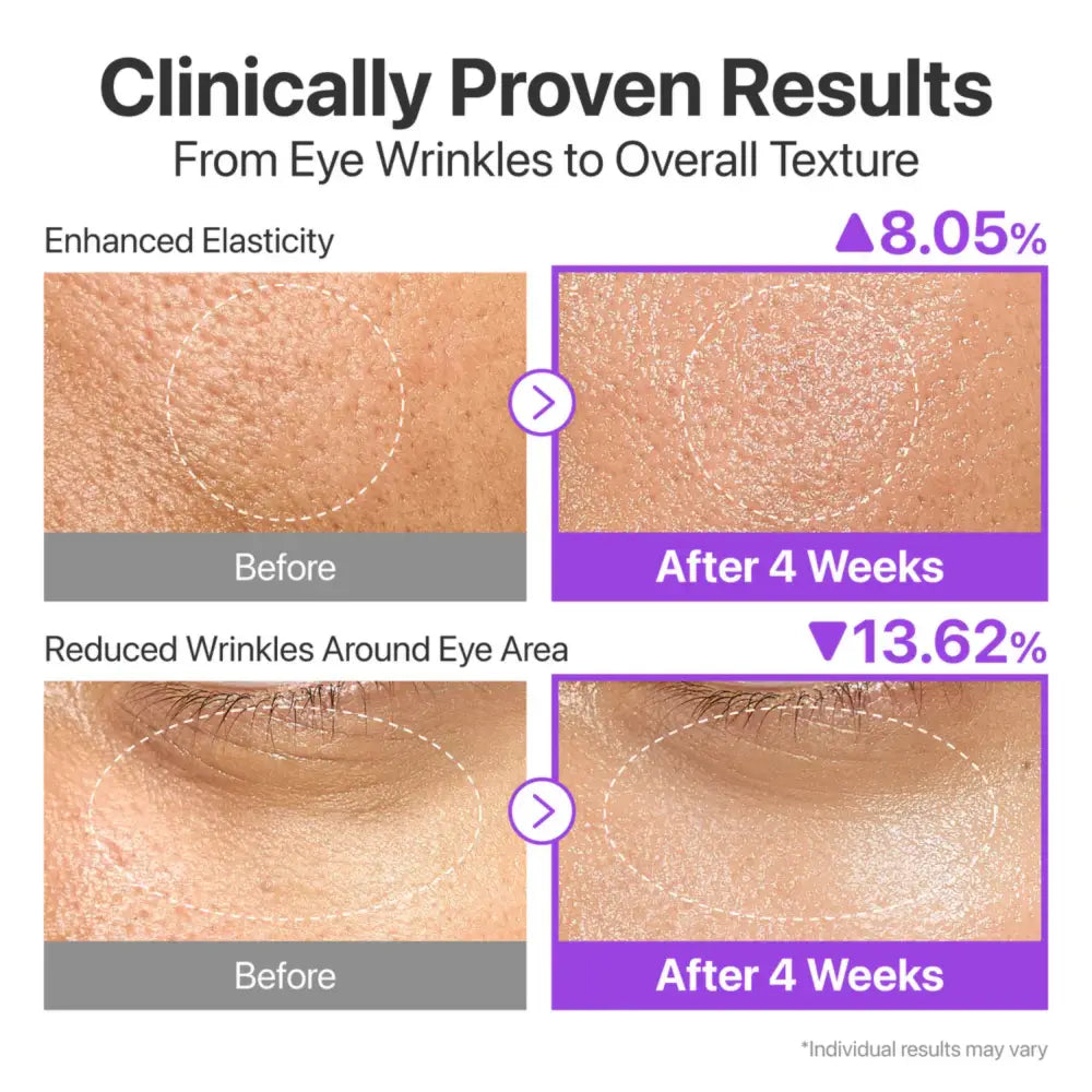 Clinically proven results of no.9 nad+ bio lifting-sil essence 50ml showing enhanced elasticity and reduced wrinkles next to authentic k-beauty essence for korean skincare south africa