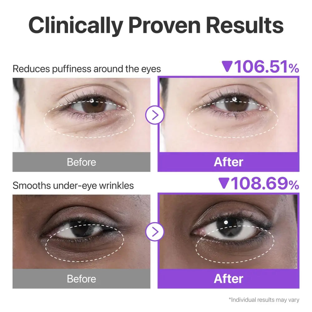 No.9 NAD+ Collagen Under Eye Patches - Care Numbuzin Skin Masks & Peels