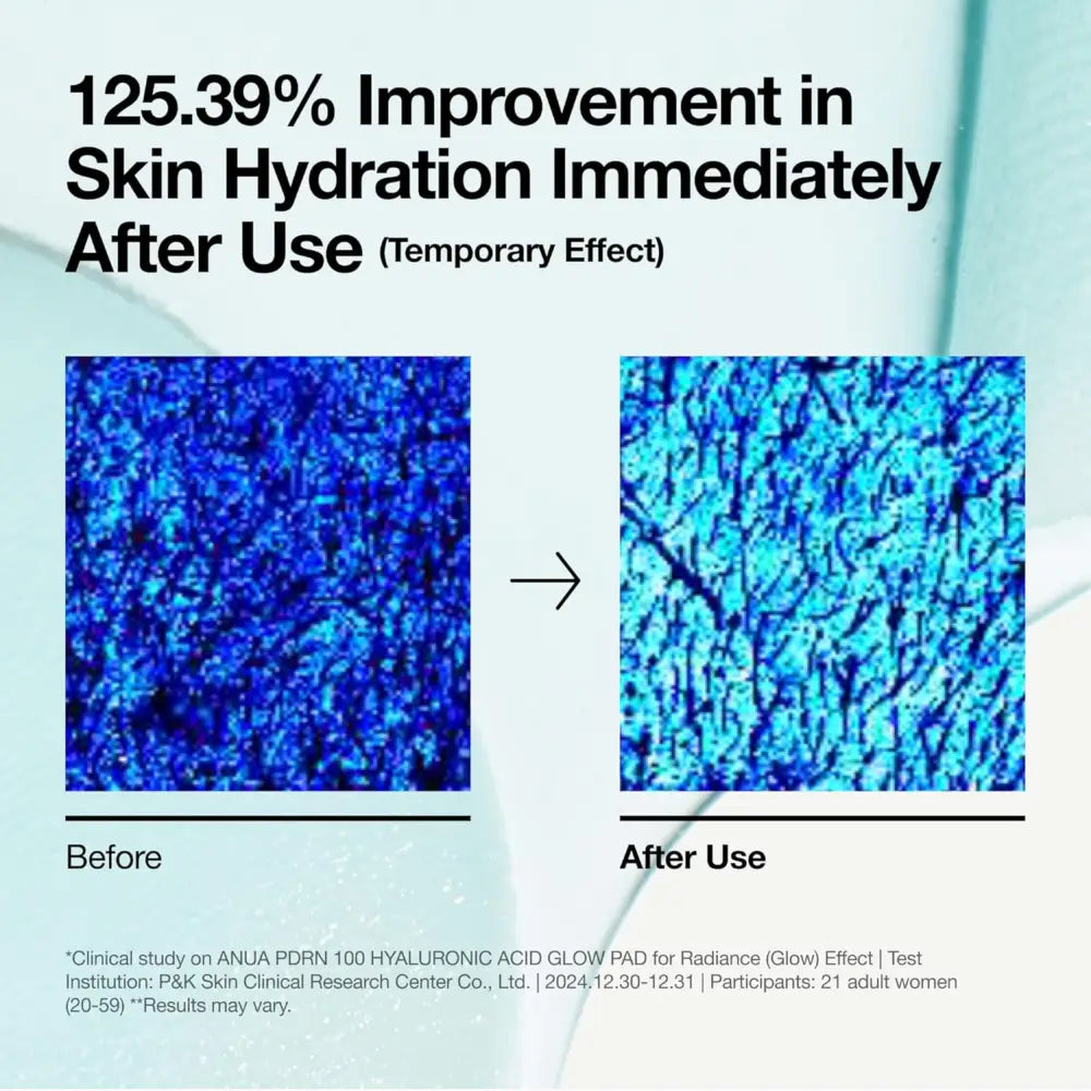 Anua pdrn 100 hyaluronic acid glow pad with textured blue gel surface for radiant skin hydration in authentic k-beauty