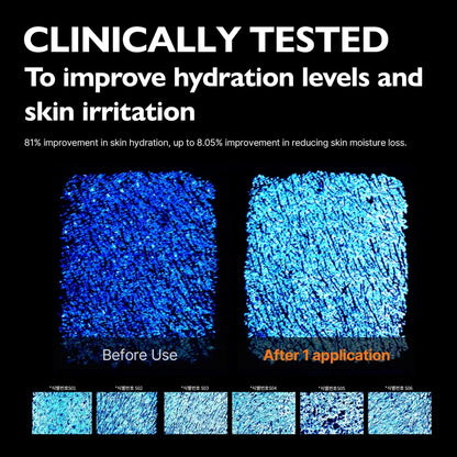 Blue textured skin hydration shown before and after using pdrn rejuvenating cream 70ml korean skincare south product
