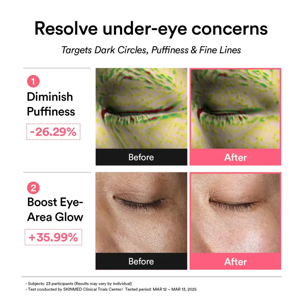 PDRN Retinal Eye Patch Glow Jelly - Care Abib Skin Masks & Peels