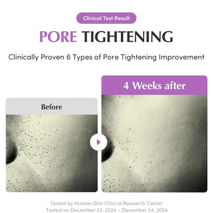 Before and after skin texture results of purple pdrn pore minimizing serum from best korean skincare brands sa after four weeks