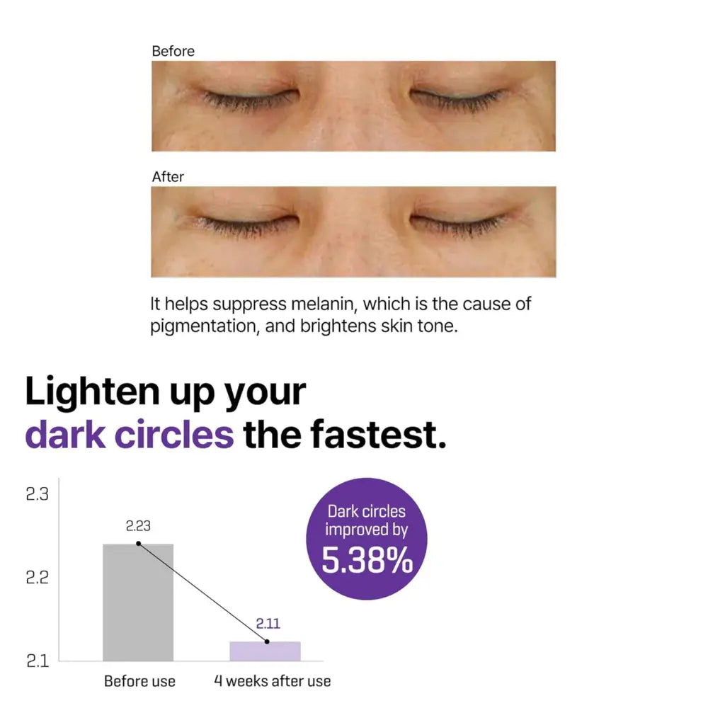 Retinol intense advanced triple action eye cream brightens skin and suppresses melanin to lighten dark circles