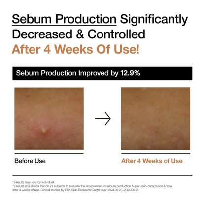 Before and after comparison of anua rice 70 glow milky toner showing improved skin barrier and reduced oiliness