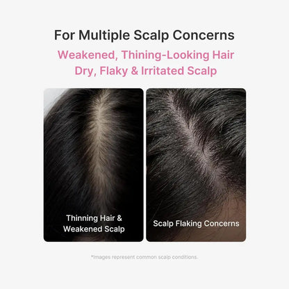 Rosemary PDRN Scalp Serum - Hair Care Medicube Serums