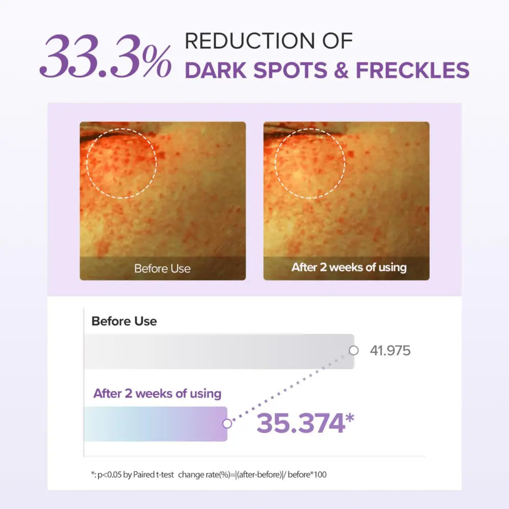 Skincare product tranexamic acid glutathione eye cream showing 33.3 percent reduction in dark spots after two weeks