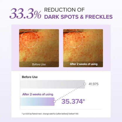 Skincare product tranexamic acid glutathione eye cream showing 33.3 percent reduction in dark spots after two weeks
