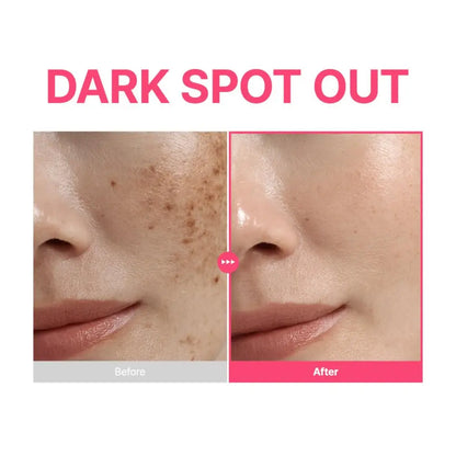 Pink dark spot out serum with niacinamide and retinal showing before and after skin improvement results in 30ml bottle